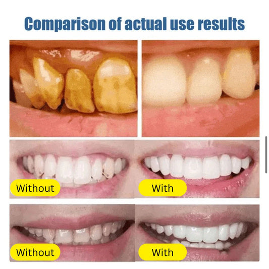 Purify Pearl Whitening Toothpaste (100 g × 2)